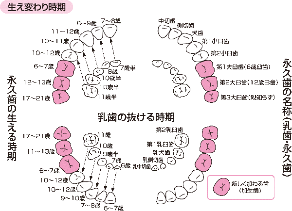 子どもでも歯周病（歯肉炎）になるってホント？